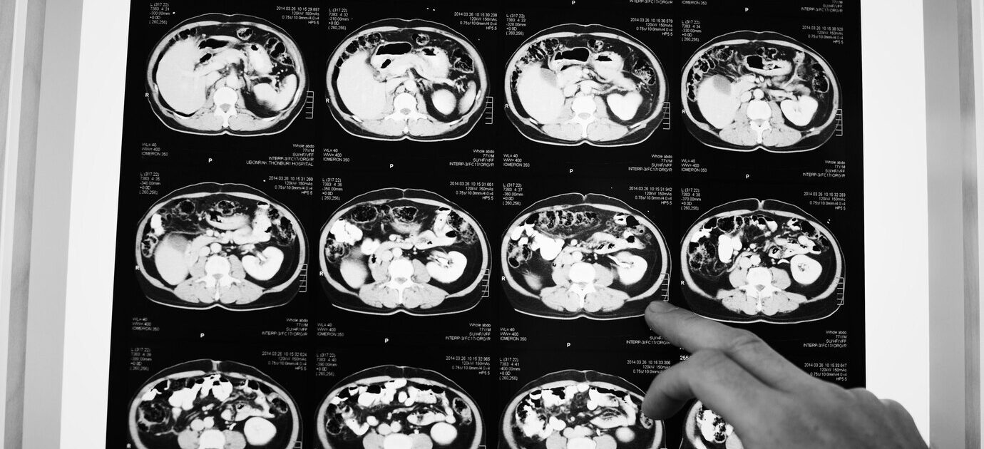 brain-ct-scan-x-ray-film_53876-31386