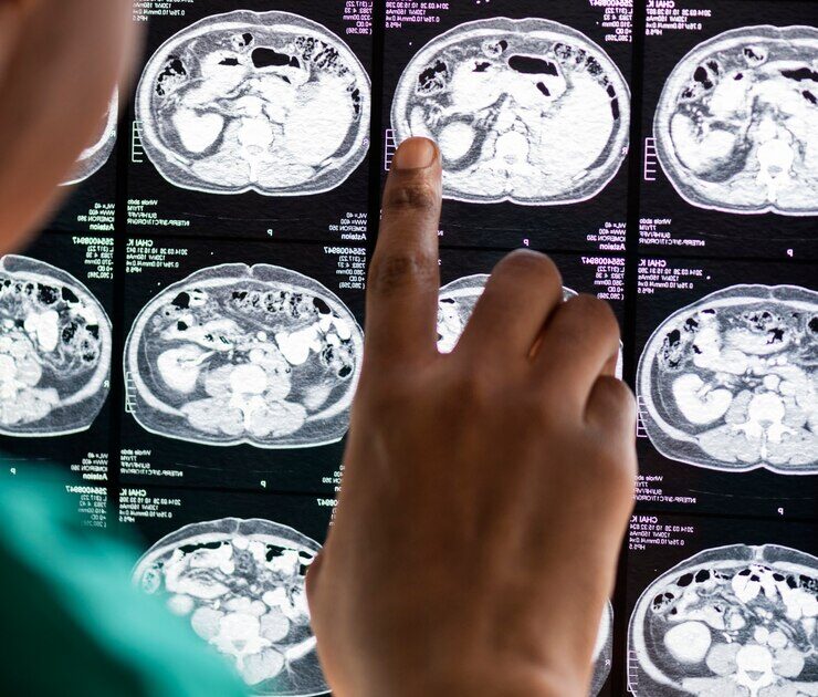 doctor-reading-brain-mri-x-ray-result_53876-14809